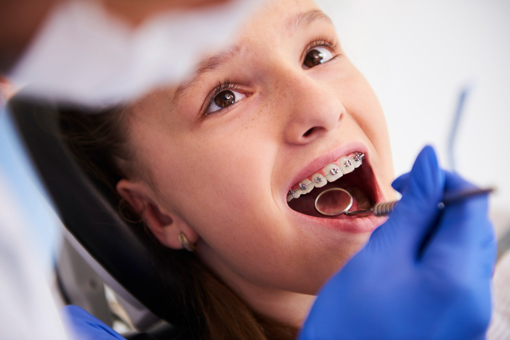 teeth braces in eldoret